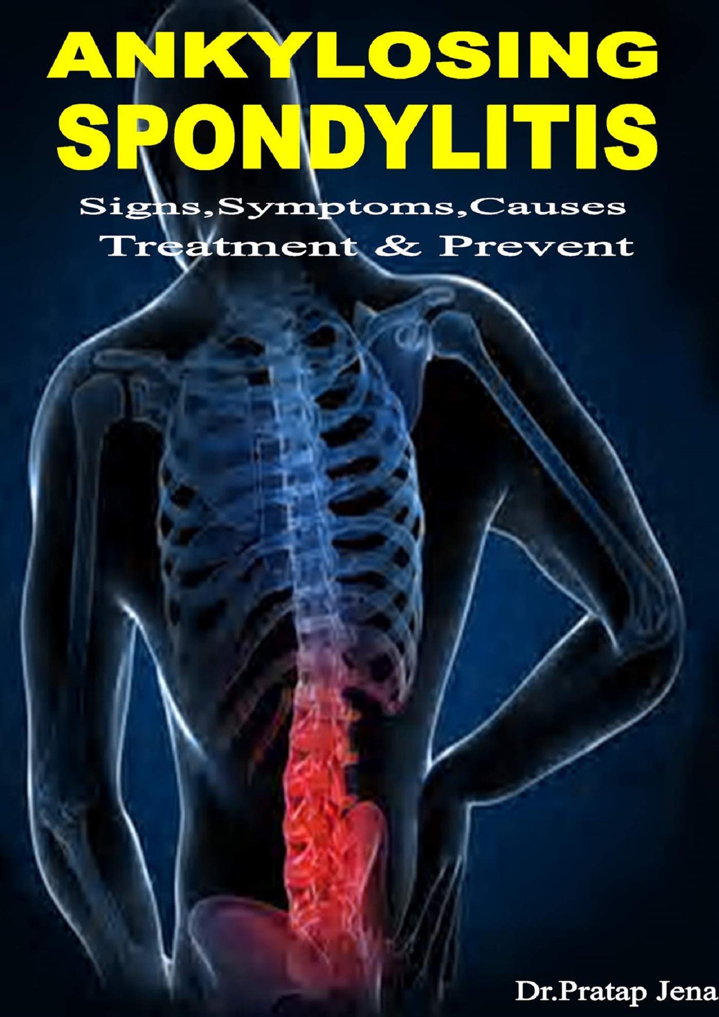 Ankylosing Spondylitis Signs Symptoms Causes Prevent Treatment Hot