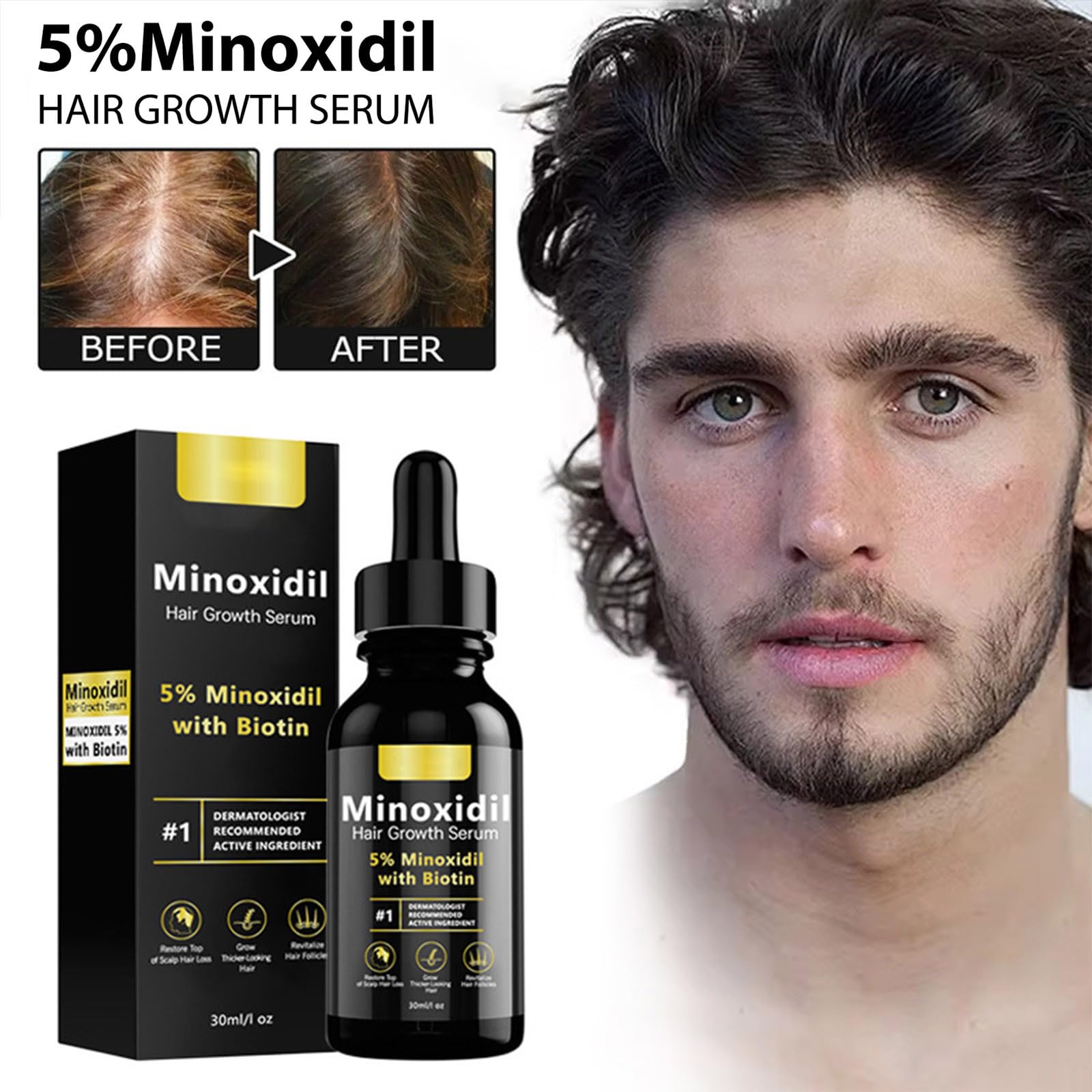 Minoxidil Hair Serum, Suitable for Both Men and Women, 5% Minoxidil Hair Growth, Resulting In Thicker, Stronger Hair. - 3