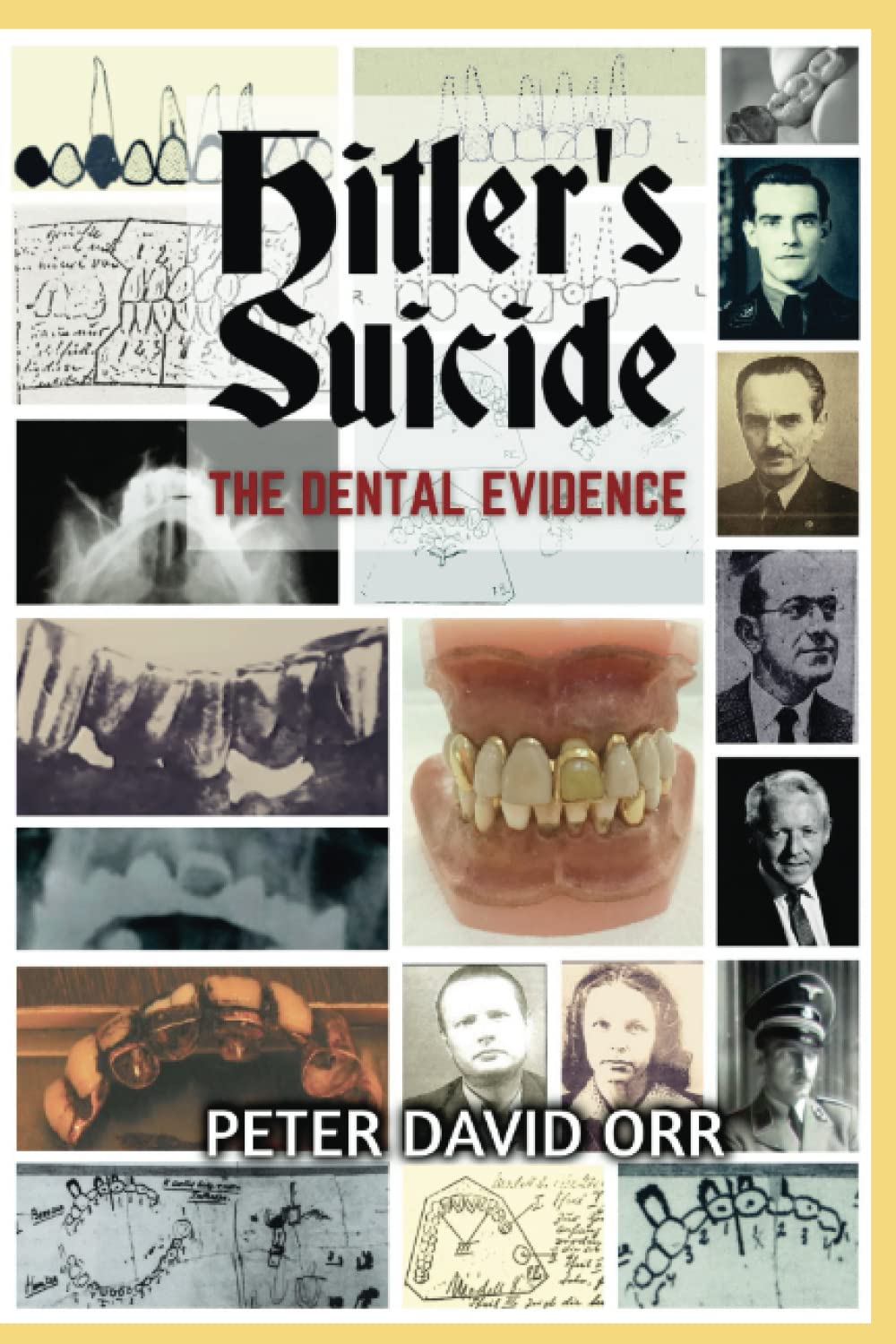 Hitler's Suicide: The Dental Evidence: 5 (Hitler's Last Days Investigation)