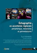 Download Echographie en anesthésie régionale: Périphérique, médullaire et périmédullaire PDF