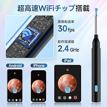Amazon.co.jp: 耳かき カメラ付き耳かき 【超高画質&可視化・6LED Amazon.co.jp: 耳かき カメラ付き耳かき 【超高画質&可視化・6LED