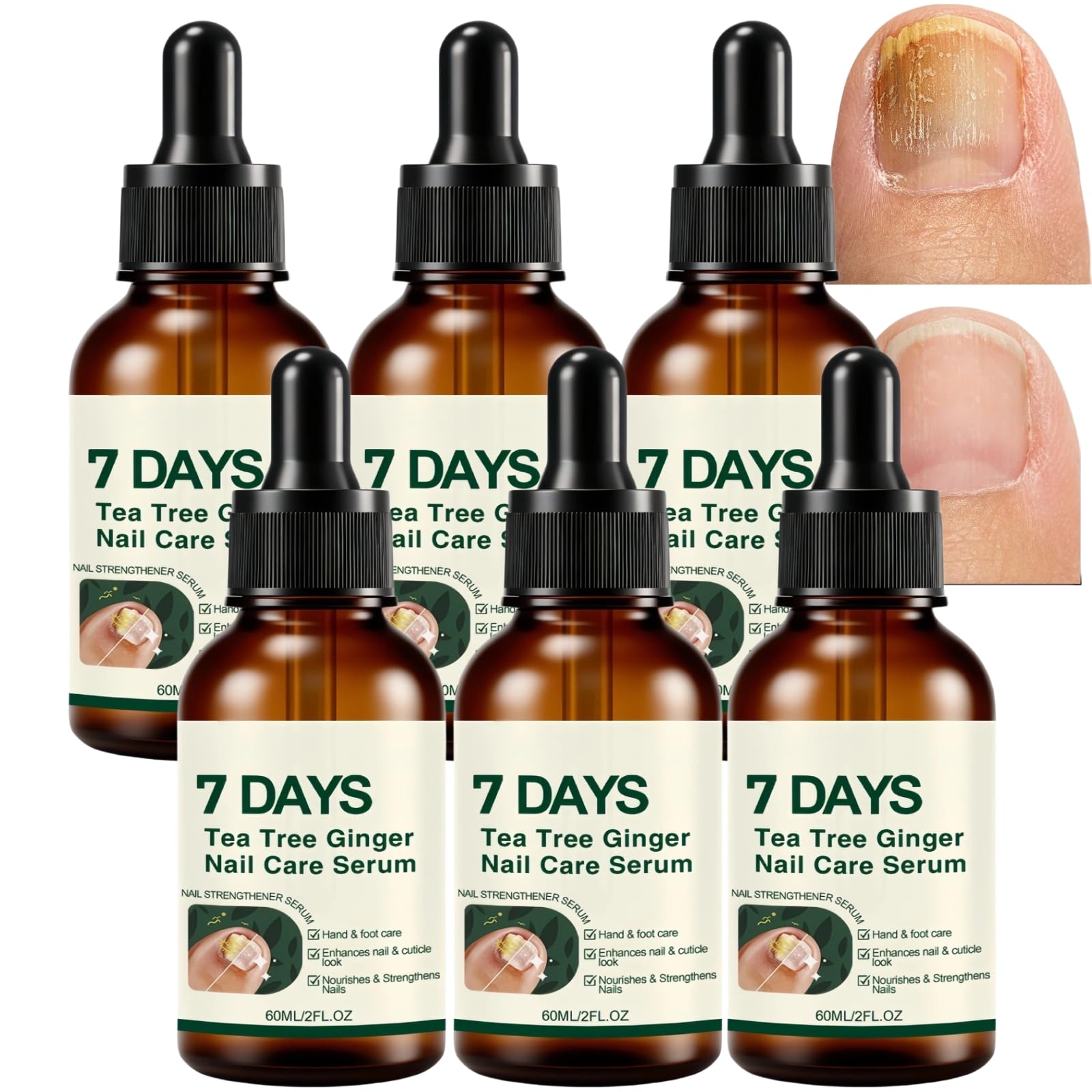 7-Tage-Nagelpflegeserum mit Teebaum und Ingwer, härtet und stärkt die Nägel, Nagelhautpflegeöl, fortschrittliche Formel für verfärbte und beschädigte Nägel, schwache und brüchige Nägel (6Stück)