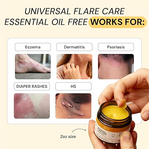 Miniatura 2 de MyMagicHealer Universal Flare Care  Sin aceite esencial  Alivio para erupciones, eczema, psoriasis, hidradenitis supurativa, impétigo, dermatitis,