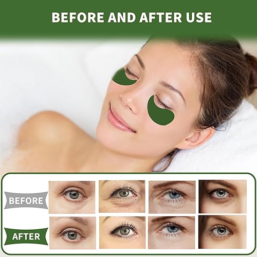 Miniatura 6 de Parches para debajo de los ojos, 70 unidades, parches de té verde para tratamiento de ojos hinchados, máscaras debajo de los ojos para ojeras e