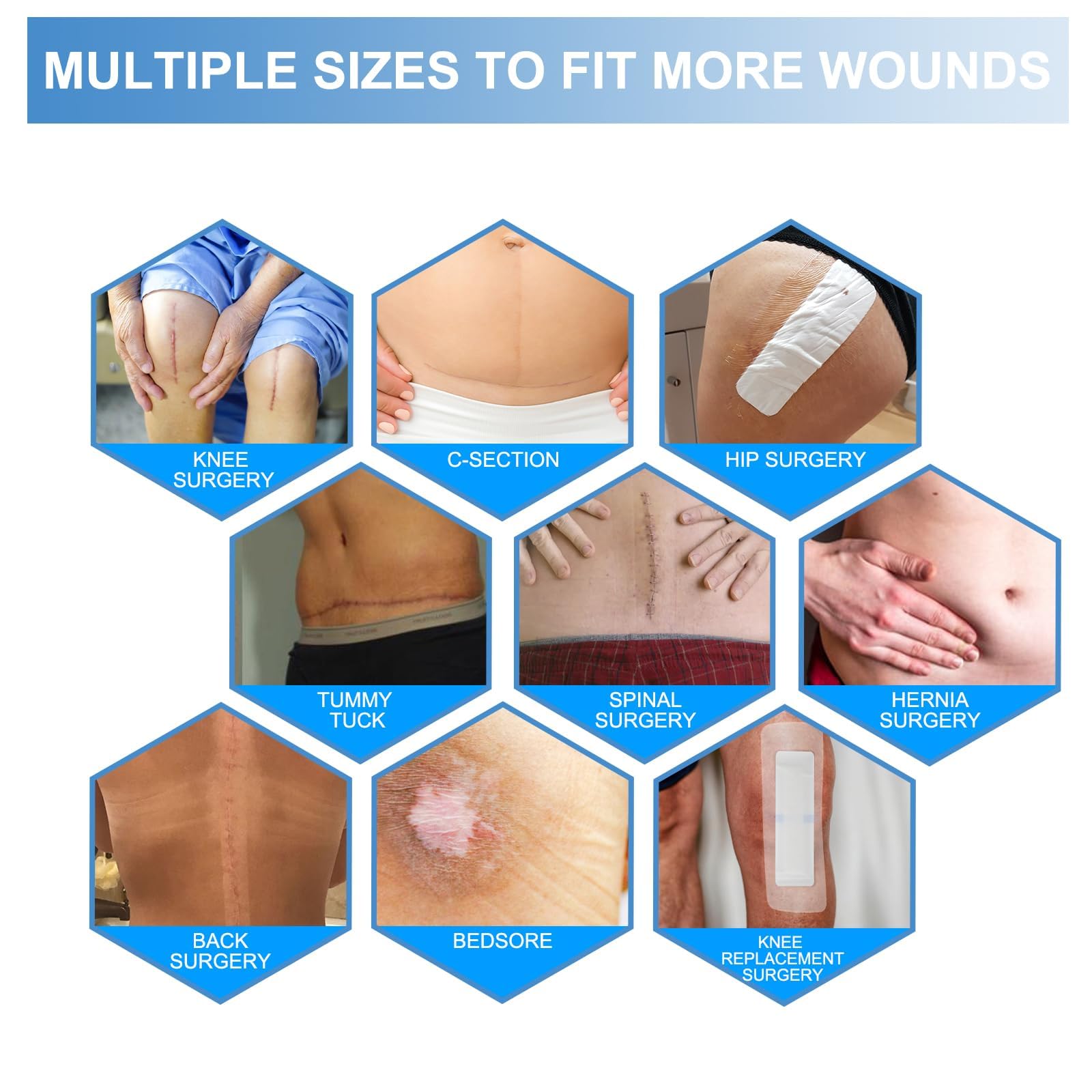 15PCS Hydrocolloid Bandage, Bed Sore Patch, For Post-Surgery Care and Chronic Wound Management, Pressure Ulcer Prevention, Sterile White Dressing,10 x 15 cm — Amazon image 7