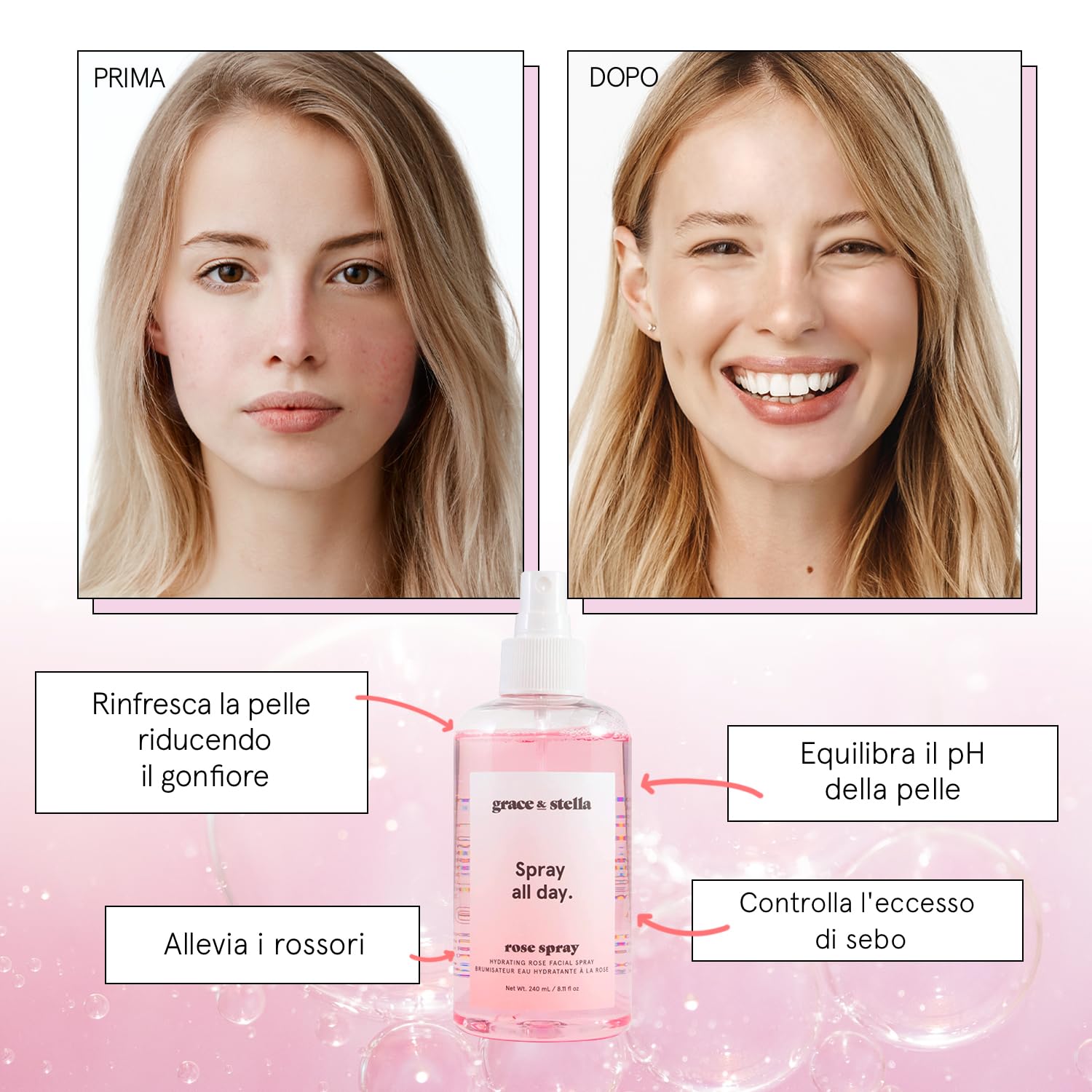 Acqua di Rose Tonico Viso in Spray (240 ml) – Acqua Distillata alle con Acido Ialuronico, Tonico Rinfrescante Ideale per Tutti i Tipi di Pelle – Riduce i Rossori ed Eccesso di Sebo