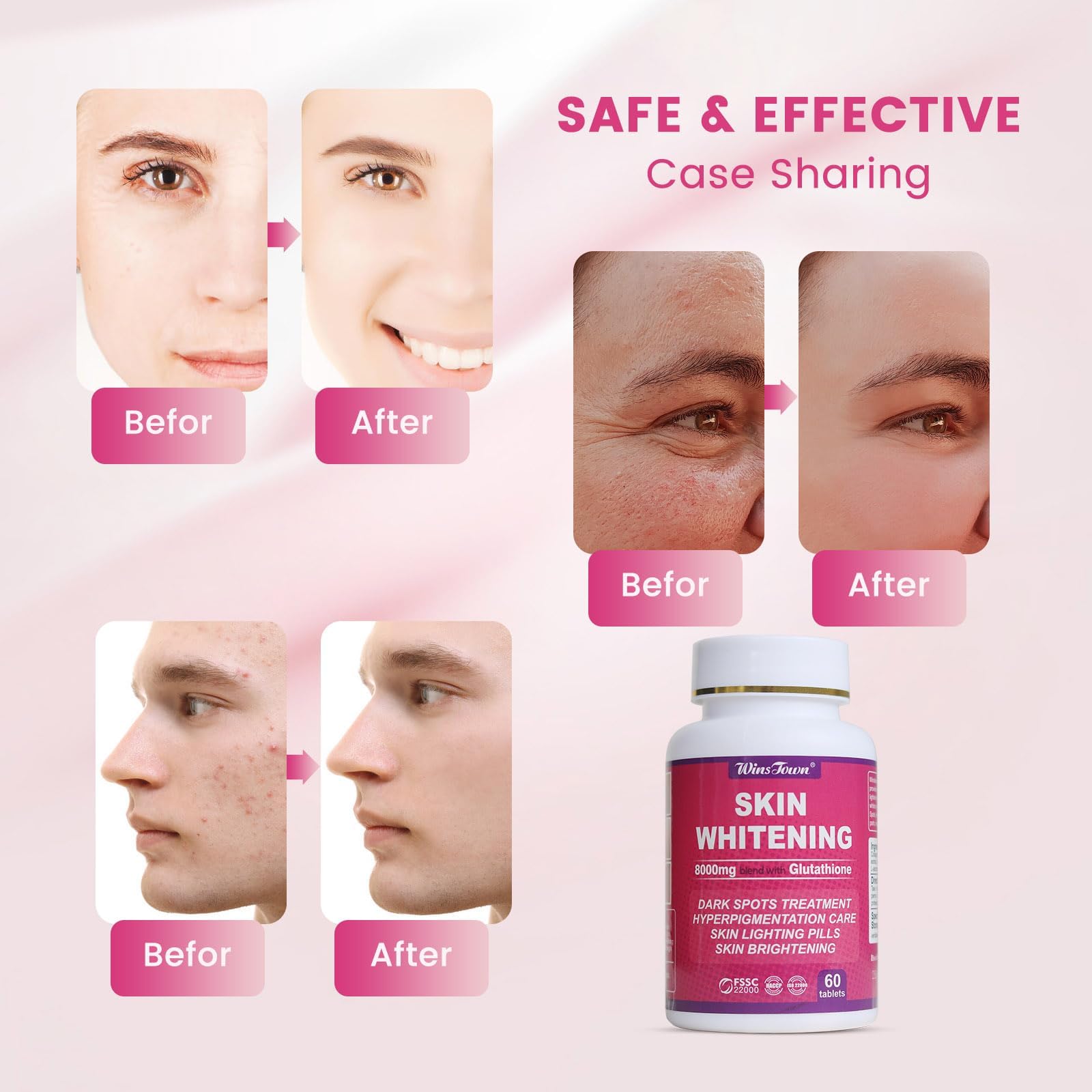 Glutathione Whitening Pills - 8000mg Glutathione - Effective Skin Lightening Supplement - Dark Spots, Melasma and Acne Scar Remover, 60 tablets : ... Glutathione Whitening Pills - 8000mg Glutathione - Effective Skin Lightening Supplement - Dark Spots, Melasma and Acne Scar Remover, 60 tablets : ...
