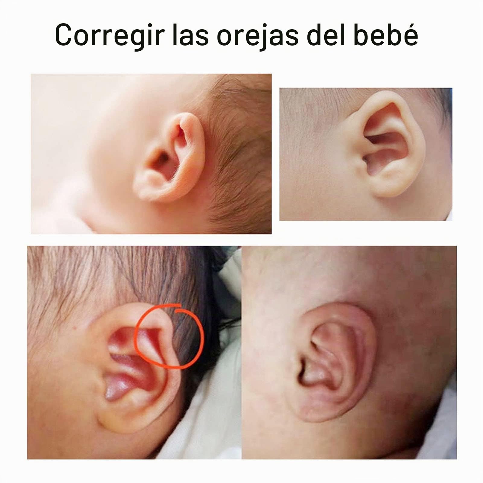 Pegatinas de Corrección de Oído para Recién Nacidos, Parches de Silicona para Orejas Deformadas, Suave y Transpirable, Uso Diario