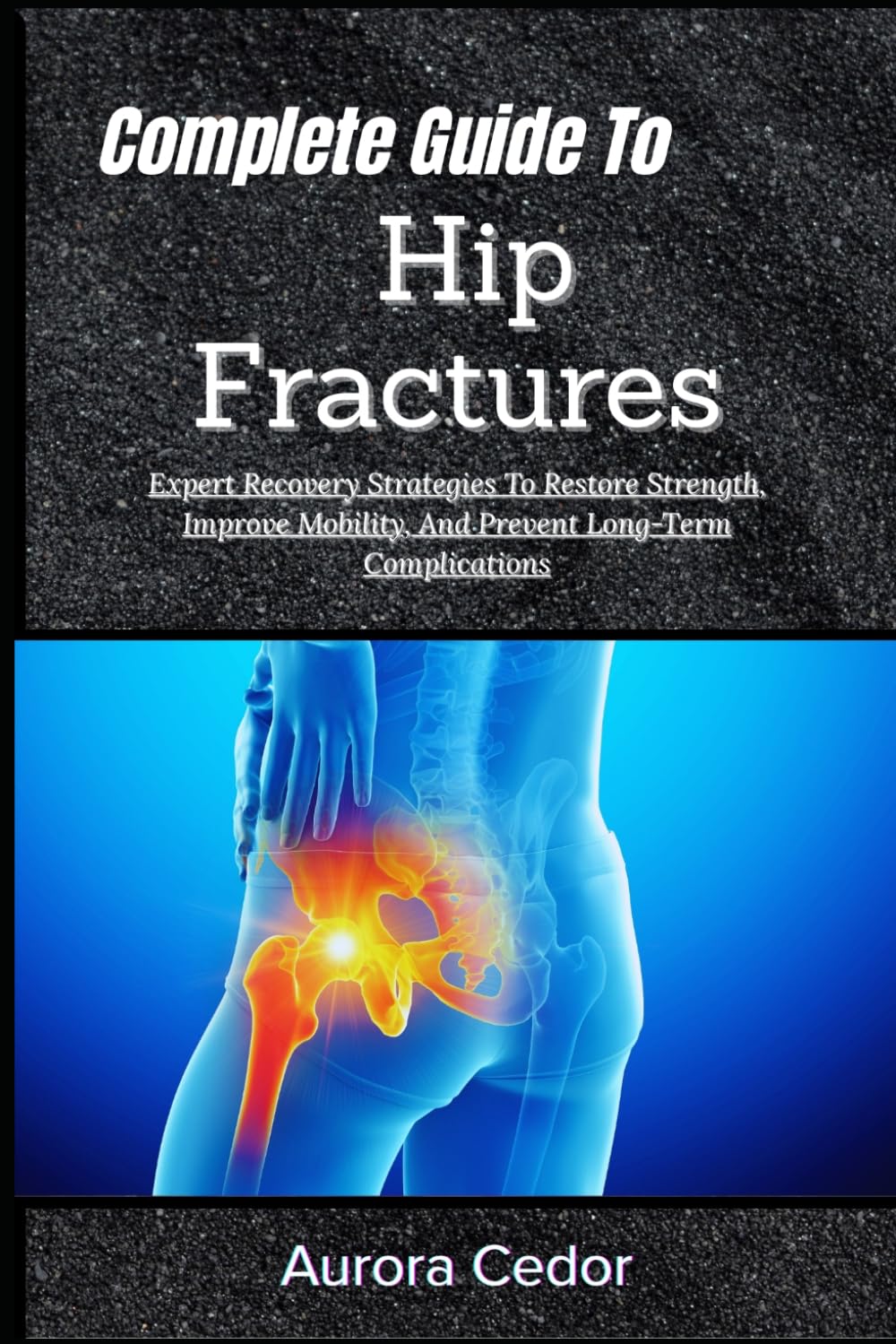 Complete Guide To Hip Fractures: Expert Recovery Strategies To Restore Strength, Improve Mobility, And Prevent Long-Term Complications