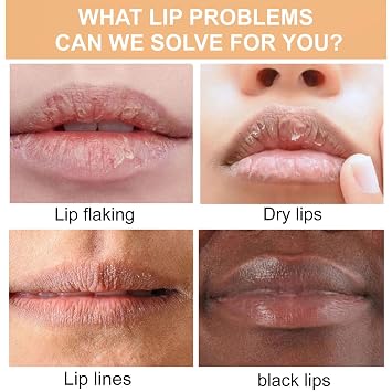 ARCHIDATE 2Pcs Turmeric Lip Balm for Dark Lips, Natural Turmeric Moisturizing Lip Balm for Smokers, Long-Lasting Moisturize Nourishes Softens Dry Chapped Dull Lips, Leaves Lips Looking Soft and Supple