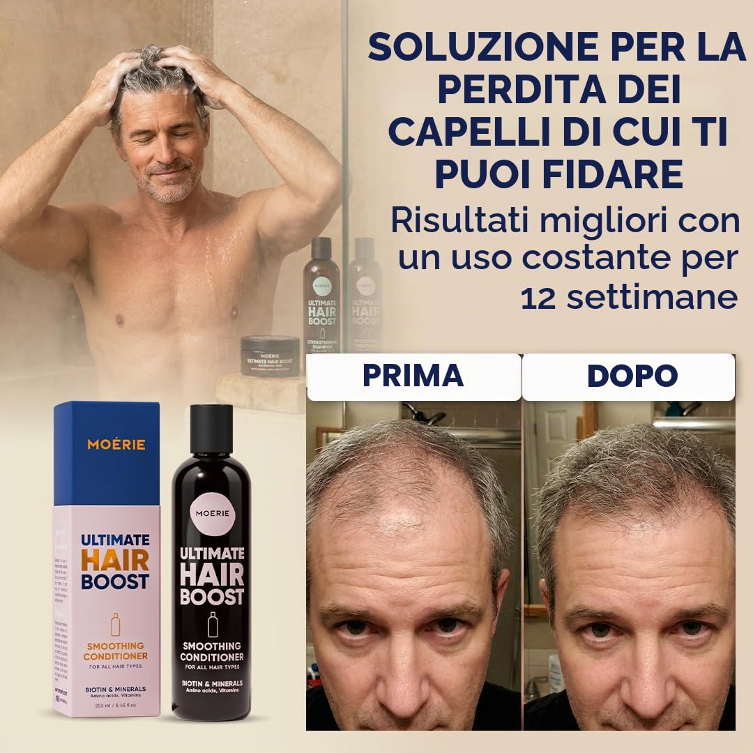 Moerie Balsamo Anti-Caduta Per Capelli Donna E Uomo, Più Lunghi E Pieni, Volumizzante, Vegan Friendly, Senza Parabeni E Silicone, Per Tutti I Capelli, Contro La Caduta Dei Capelli (250 Ml)x2