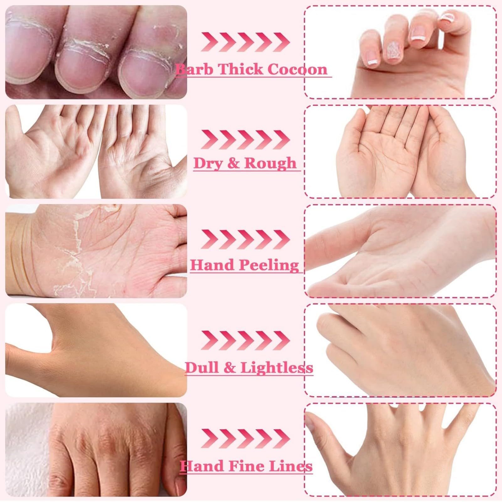 Masque Pour Les Mains, Masques Hydratants Pour Les Mains, Gants Hydratants Pour La Nuit Pour Les Mains Sèches Et Gercées, Rajeunit Et Répare La Peau Rugueuse Des Mains, 8 Pièces