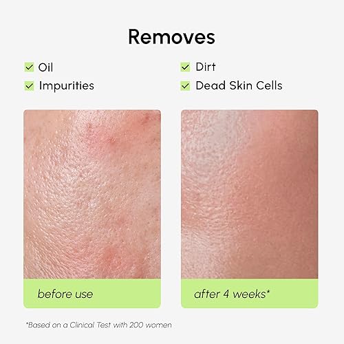 Miniatura 5 de MAREE Tónico Exfoliante con Ácido Salicílico  Exfoliante Facial AHA BHA & Limpiador de Poros  Exfoliante Líquido BHA para Cuidado de Sebum y Piel