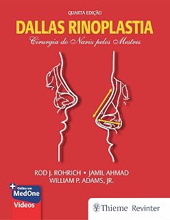 Dallas Rinoplastia: Cirurgia do Nariz pelos Mestres (Portuguese Edition)
