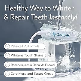 Snow Teeth Whitening Kit - Snow Teeth Whitening Serum and LED Mouthpiece Whitener, Formulated with Hydroxyapatite, Good for 6 Months - Wireless Kit with 3 Wands
