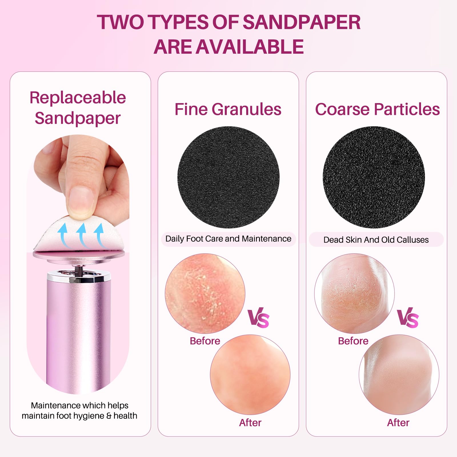 LIONVISON Electric Foot Callus Remover: Adjustable Speed Foot File for Cracked Heels - Working Women's Summer Pedicure Tool with 60pcs Sandpaper Discs - Dead Skin Remover for Dry Feet at-Home