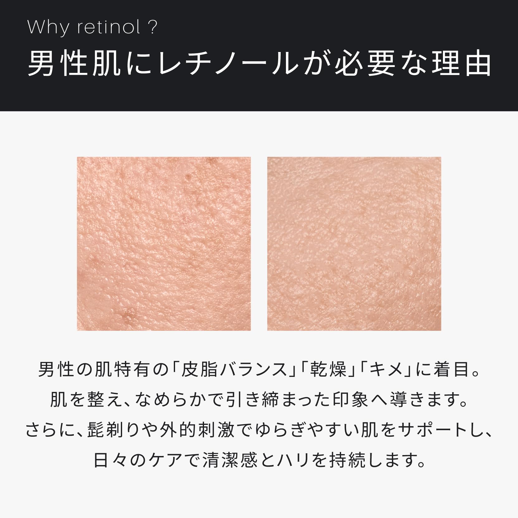 Amazon.co.jp: ATIDIMU メンズ美容液 30mL｜レチノール誘導体