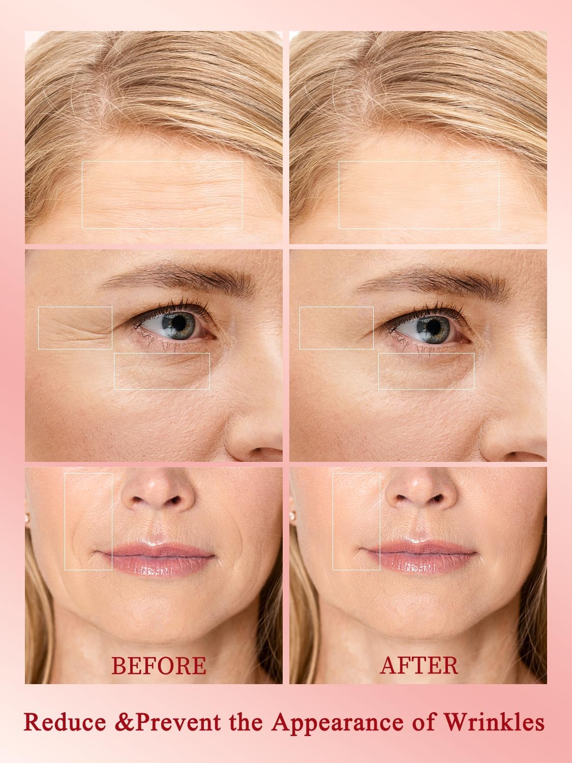 Radio Frequency Skin Tightening Device, Professional Wireless Home RF Skin Tightening Face Machine, 3 Levels for Smooth Fine Lines, Lifting, Firming