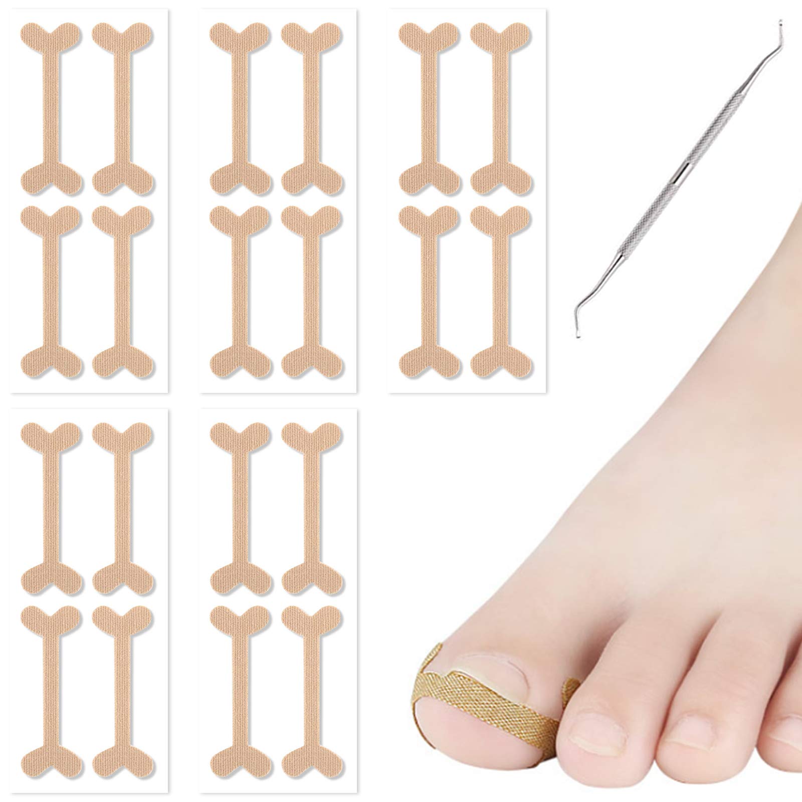 Buy Ingrown Toenail Tool 20 PCS Ingrown Toenail Correction Stickers