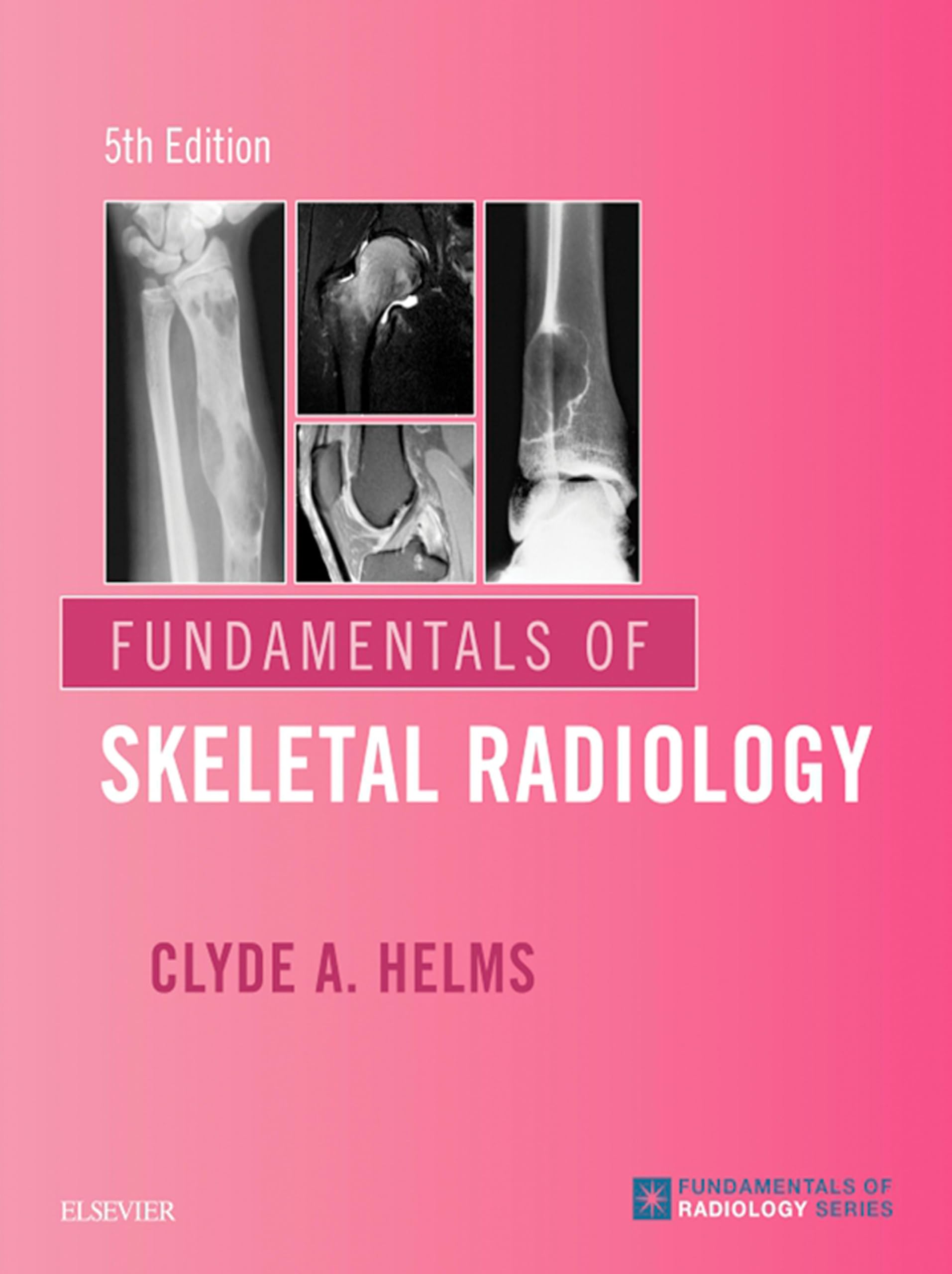 Fundamentals of Skeletal Radiology E-Book (English Edition)