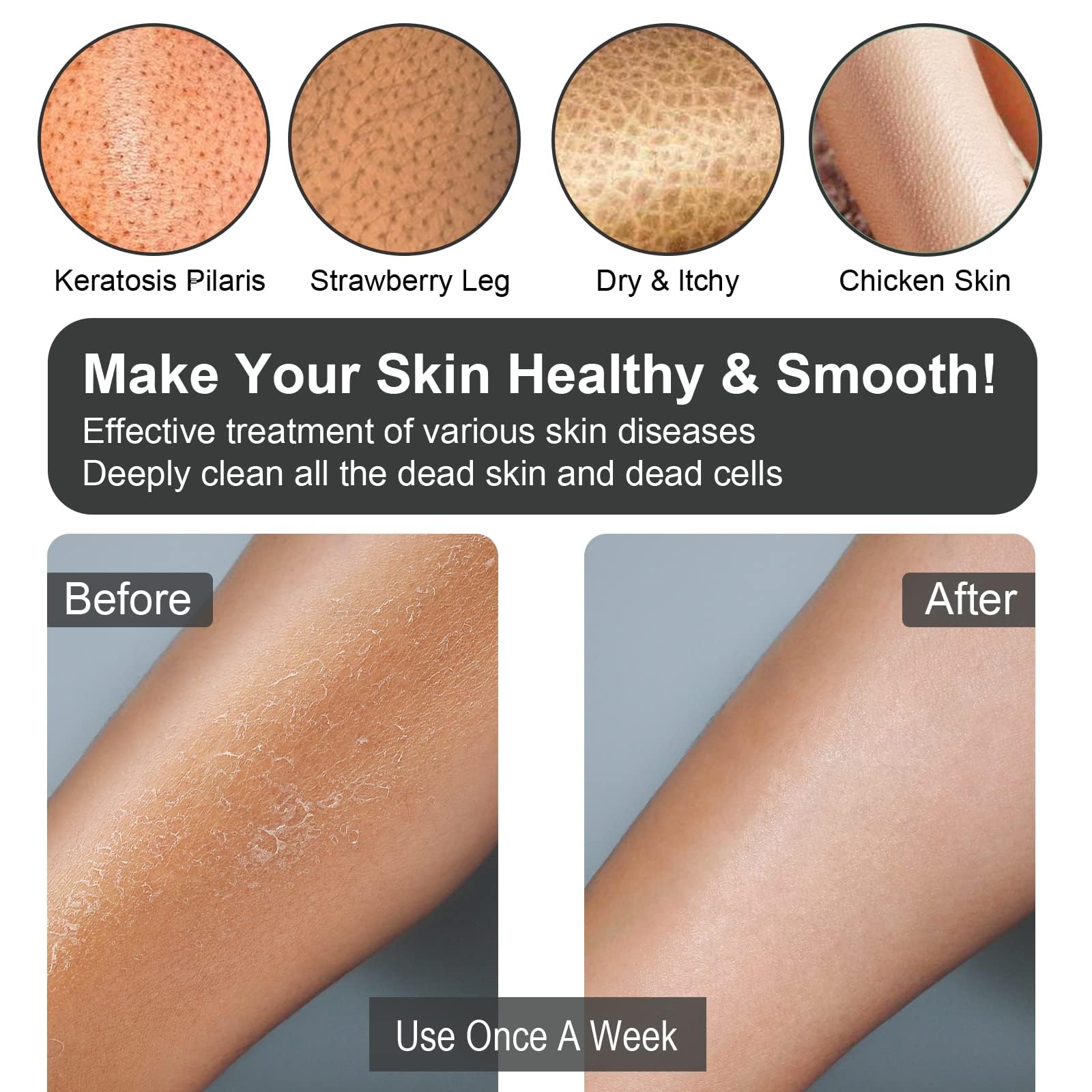 Guantes exfoliantes coreanos 2 piezas, exfoliante corporal para baño ducha exfoliante manopla exfoliación, exfoliante corporal, guante removedor de piel muerta para mujeres hombres
