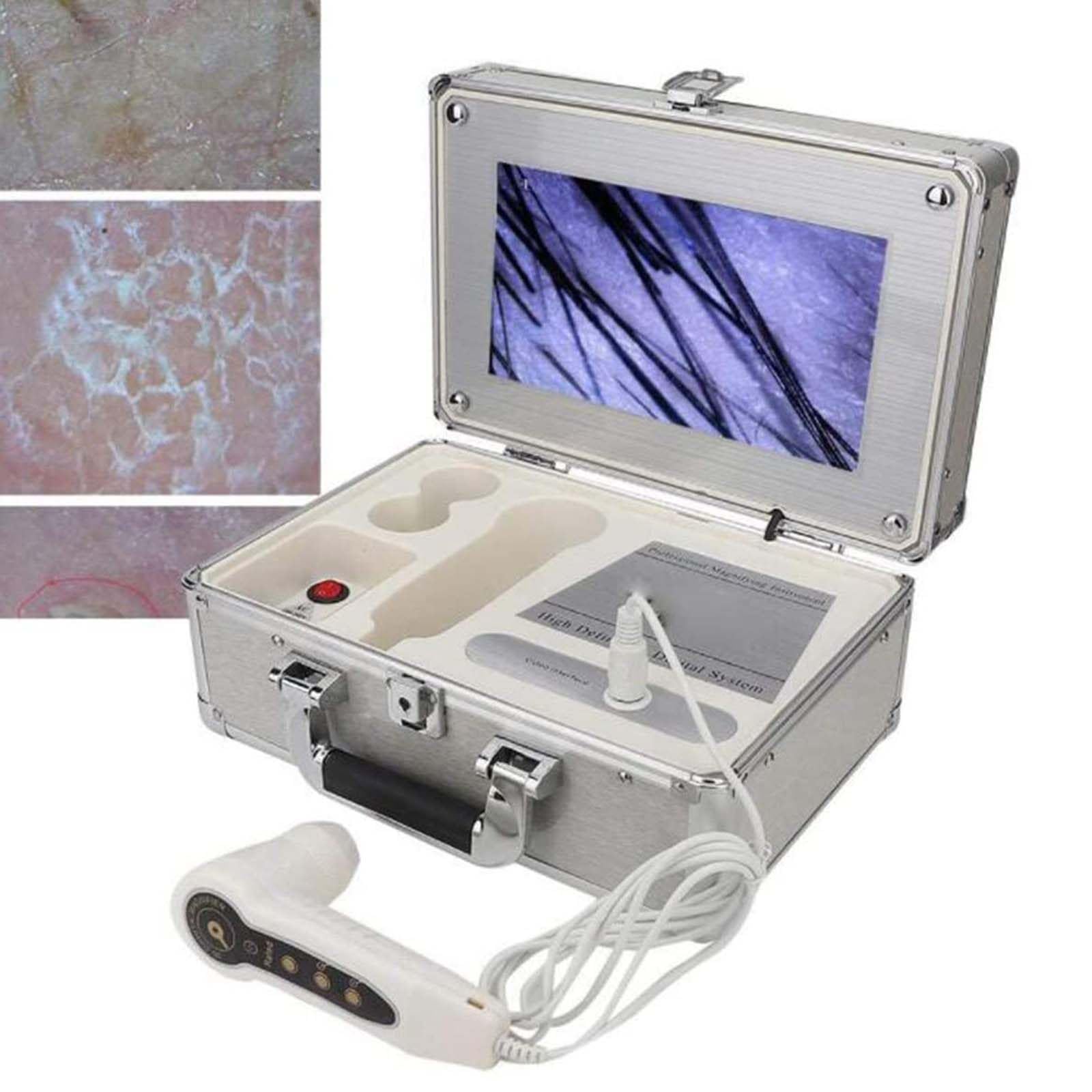 Analizator skóry głowy do włosów, 9 cali HD Smart Skalp, analiza mieszków włosowych, przyrząd do analizy skalpów, 50x/200x detektor skóry twarzy, do testów mieszków włosowych, problemów