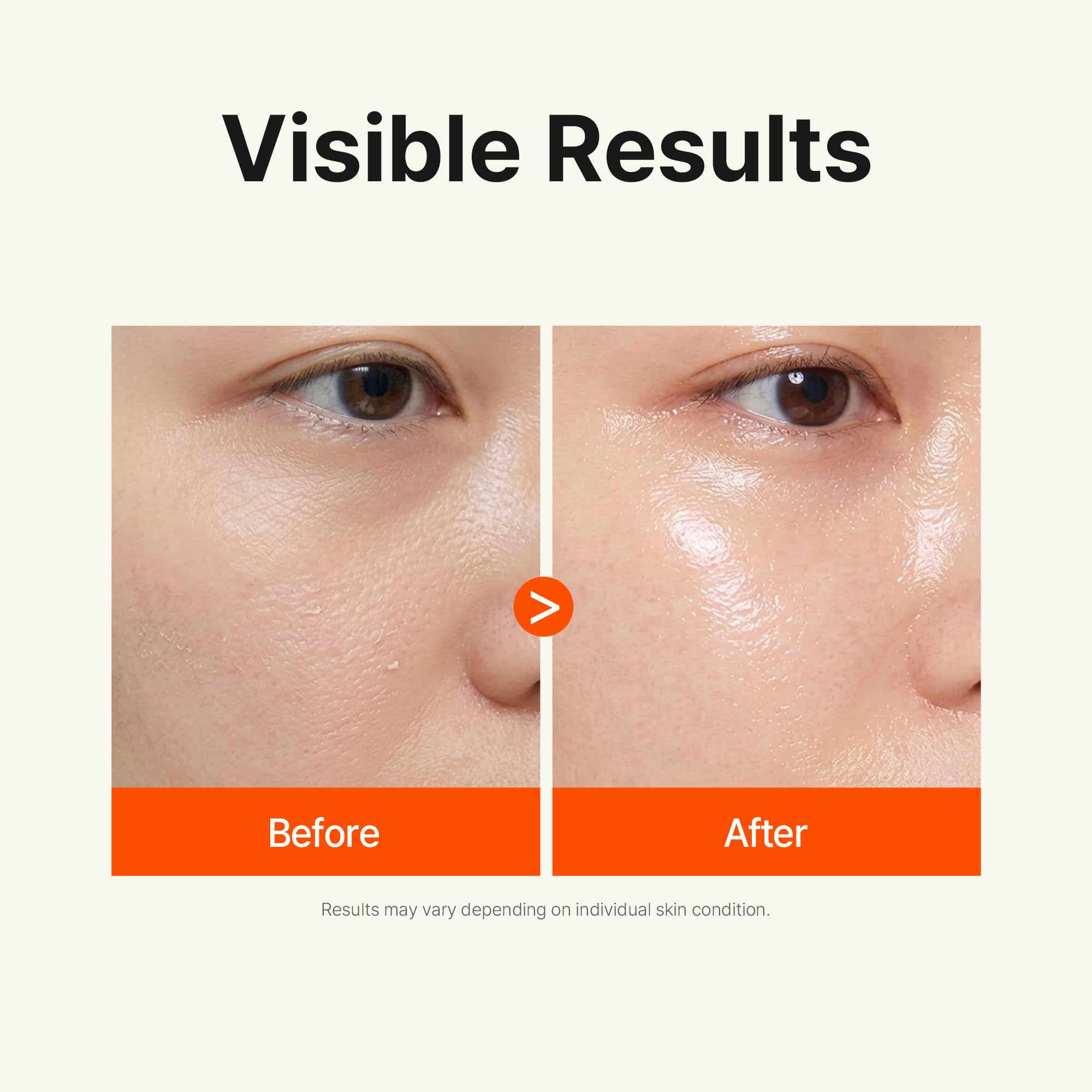 Ariul Expert Vita Exosome Collagen Hydrogel Mask (Set Of 4) - Vitamin & Eksozom Kolajen Yenileyici