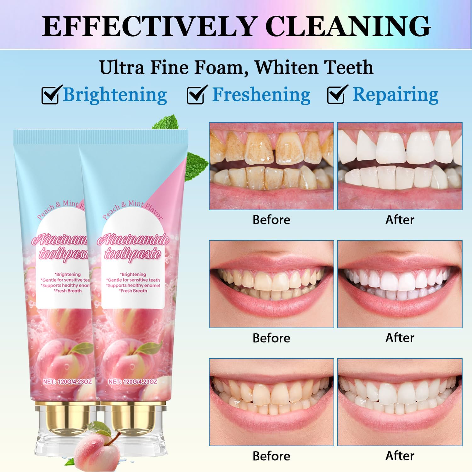 Pasta de dientes blanqueadora de niacinamida contra manchas y reparación del esmalte, pasta de dientes suave para dientes sensibles, aliento fresco, brillante, cuidado bucal diario natural para