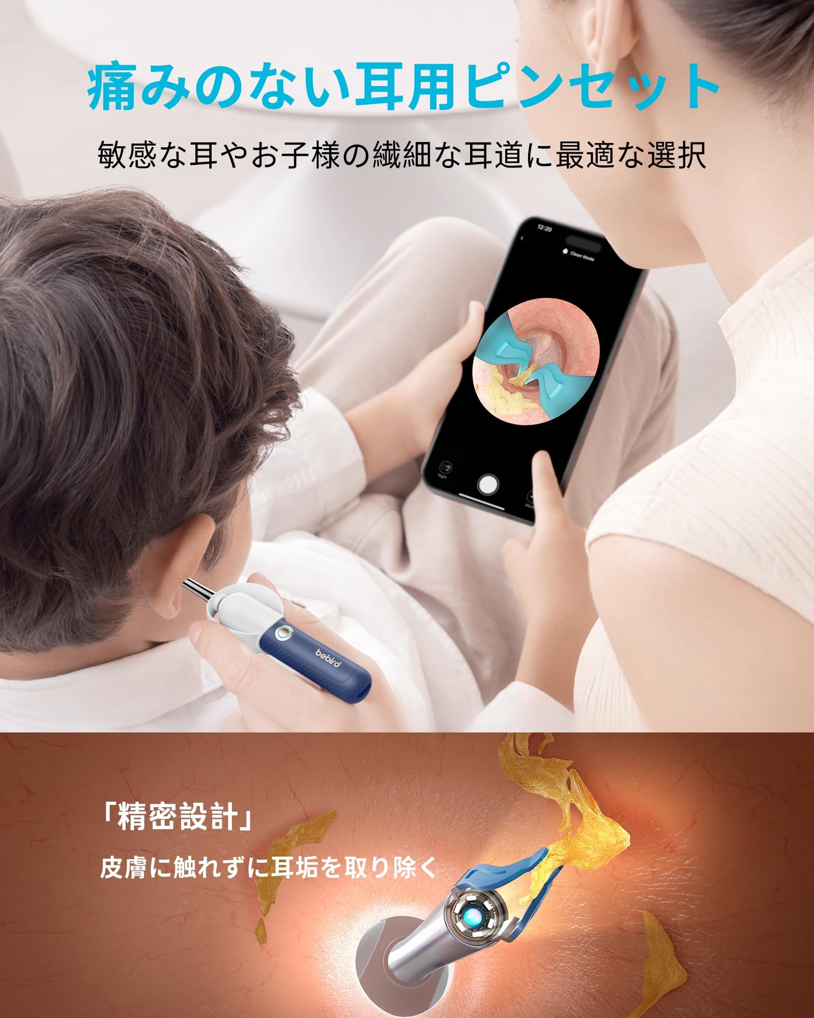 Amazon.co.jp: 【Amazon.co.jp限定】Bebird Earsight Plus みみかき