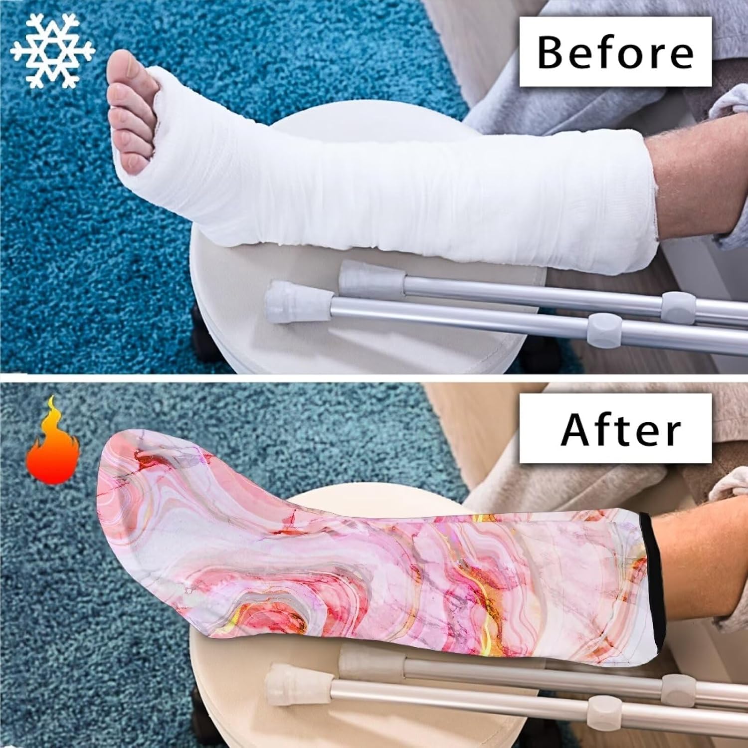Rnyleeg Pink Marble Cast Cover for Foot Fashion Leg Cast Cover Sock for Women Bath Shower Cast Wound Covers Warm Foot Cast Sleeve