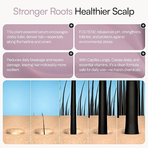 Miniatura 5 de FOLTENE Tratamiento para el cabello y el cuero cabelludo para mujeres (nuevo embalaje)  Solución de pérdida de cabello con tricalgoxilo para