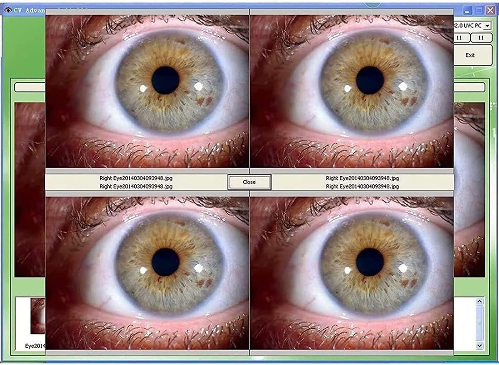 診断革命　虹彩診断による治療　東洋虹彩分析 診断革命虹彩診断による治療と予防 |本 | 通販 | Amazon