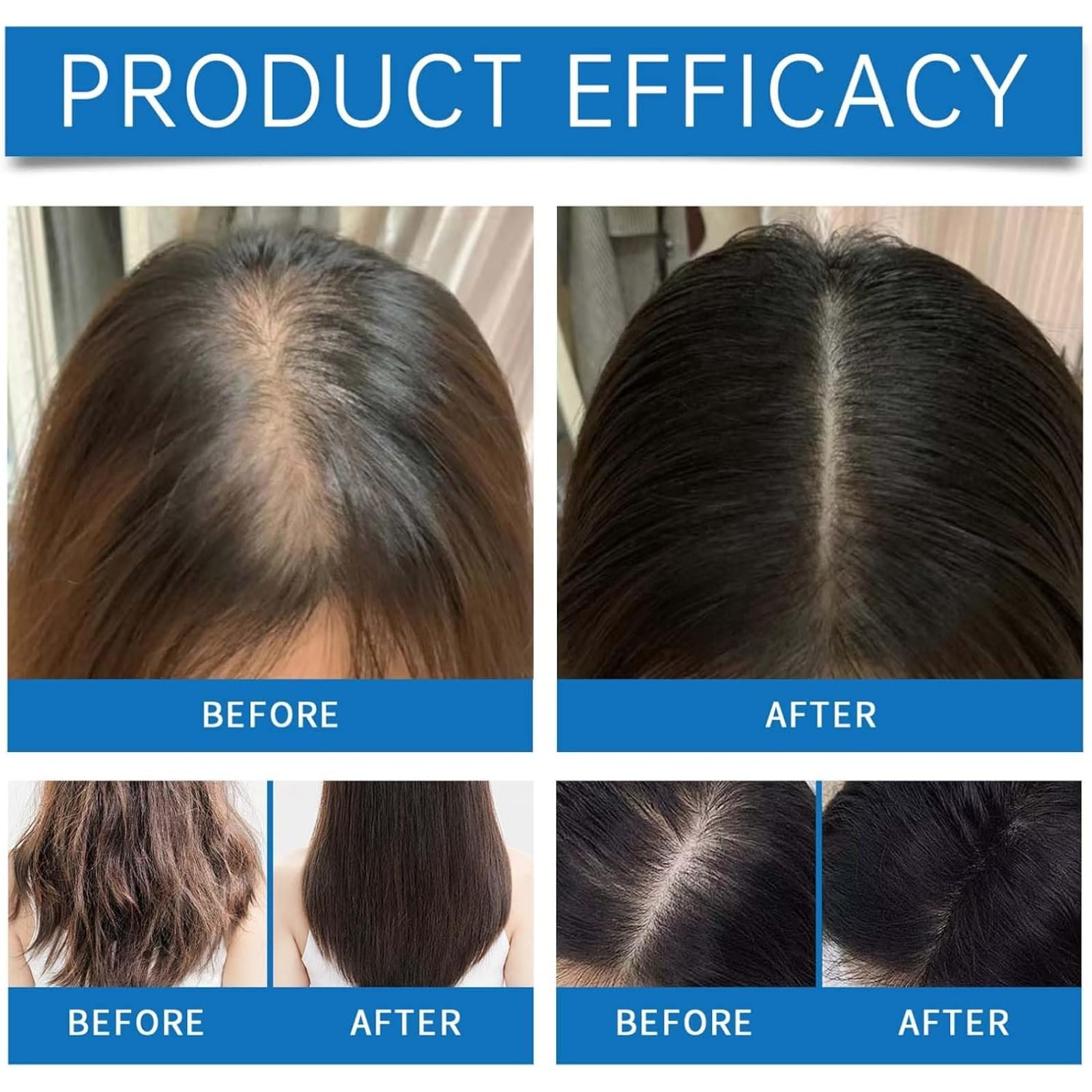 Seapuari Scalp Serum – Contro La Caduta, Volume E Radici Rafforzate. Mantiene Il Cuoio Capelluto Pulito. Ideale Per Uso Quotidiano Su Capelli Fragili (Uomo/Donna) (4 PCS)