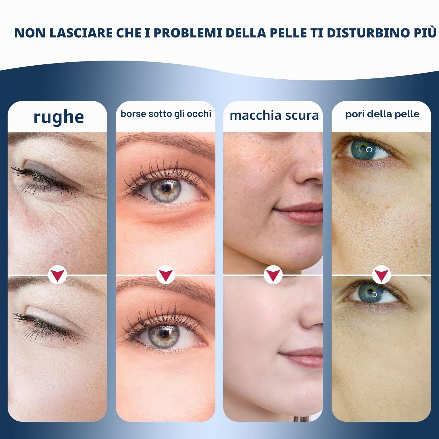 Dispositivo di bellezza pulsante, dispositivo avanzato a radiofrequenza per il viso con tecnologia a impulsi e microcorrenti, riduzione delle rughe, cura della pelle.