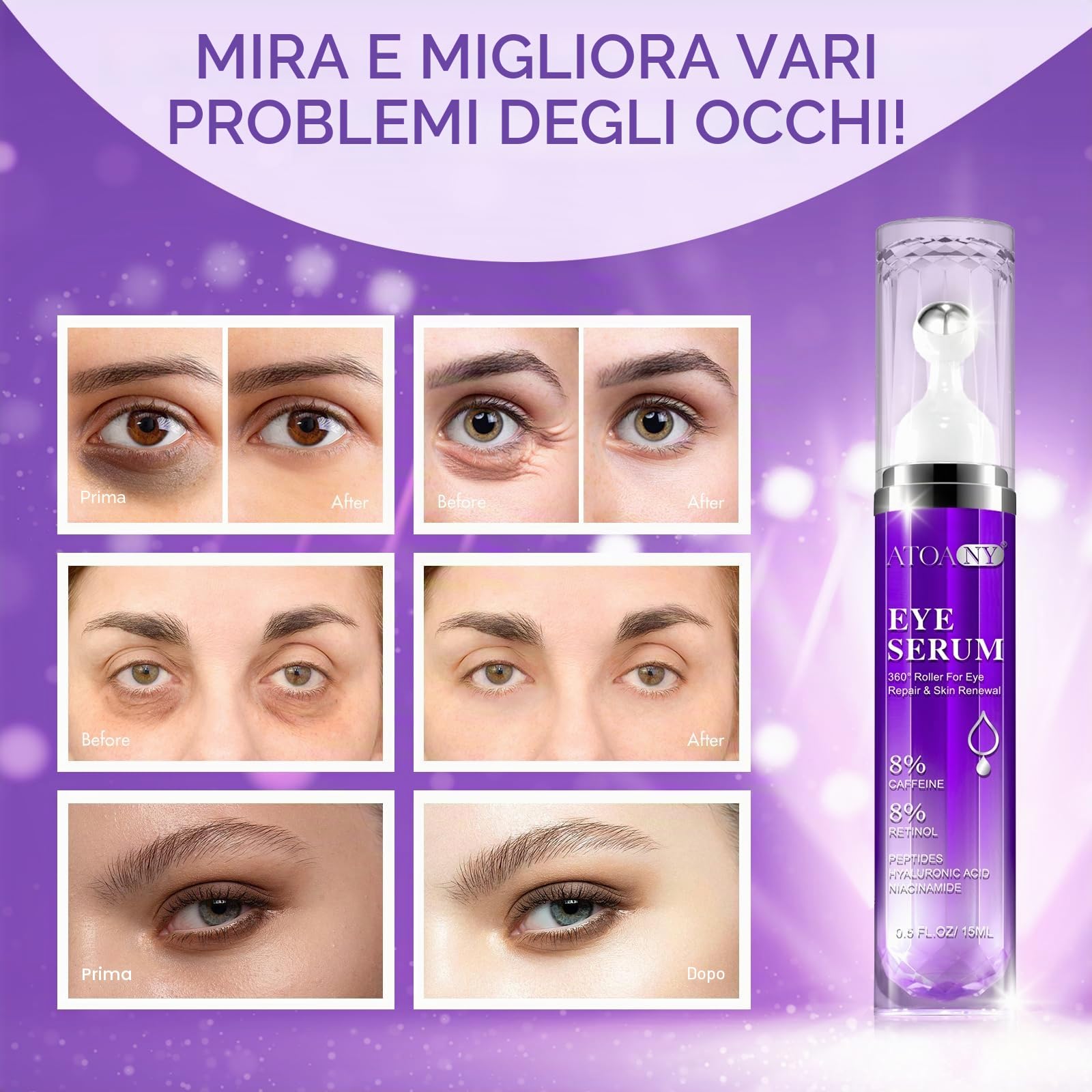 Siero per occhiaie e borse sotto gli occhi con 8% di caffeina 8% retinolo, ialuronniacinamide, anti-invecchiamento per borse e gonfiori, con pallina massaggiante a 360° per donne e uomini