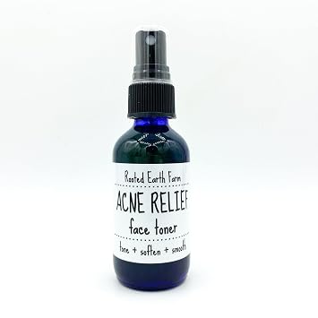 Acne Toner - 2 fl oz - Astringent for Face - Natural and Herbal Infused