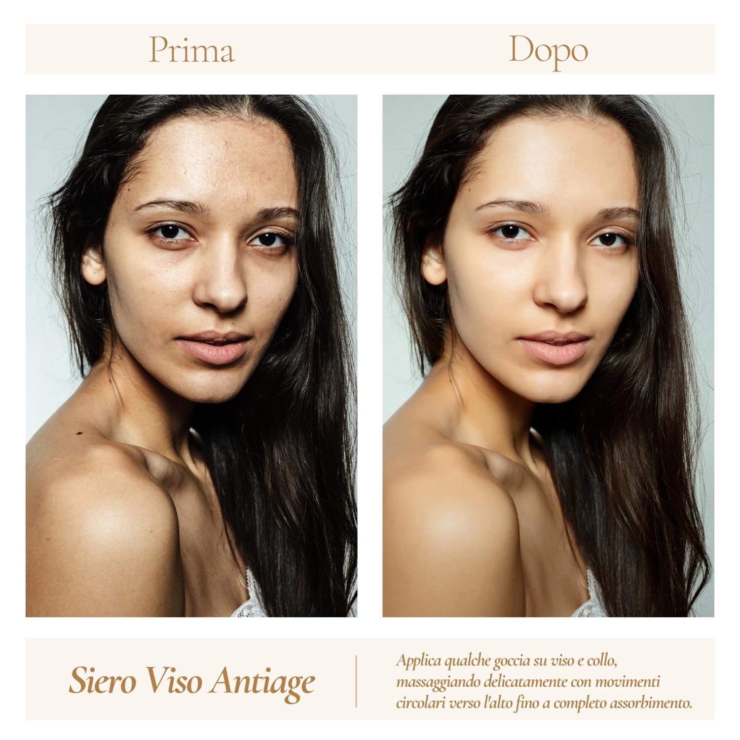 AMOR TUO LAB®| Siero Viso Acido Ialuronico Puro 3 Pesi Molecolari - Siero Viso Antirughe - Effetto Tensore, Rimpolpante, Elasticizzante - Effetto Botox Naturale - Ideale per Skincare e pelli delicate