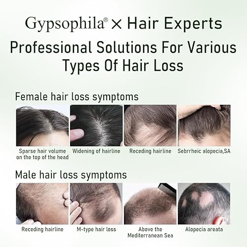 Miniatura 3 de Paquete de aceite de Batana para el crecimiento del cabello, aceite de romero natural 100% puro y champú para el crecimiento del cabello,