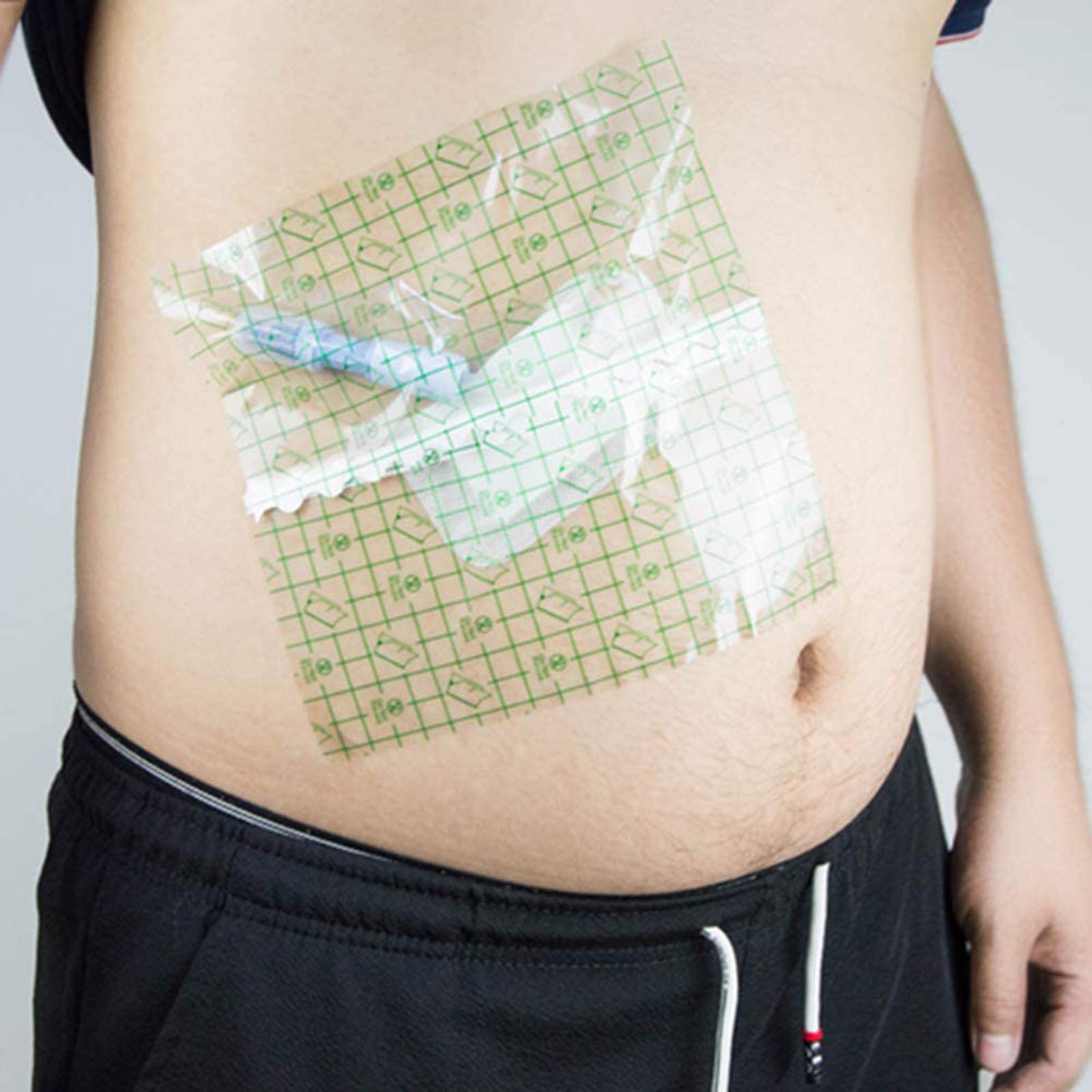 Buy Nlight Peritoneal Dialysis Bath Film Peritoneal Waterproof