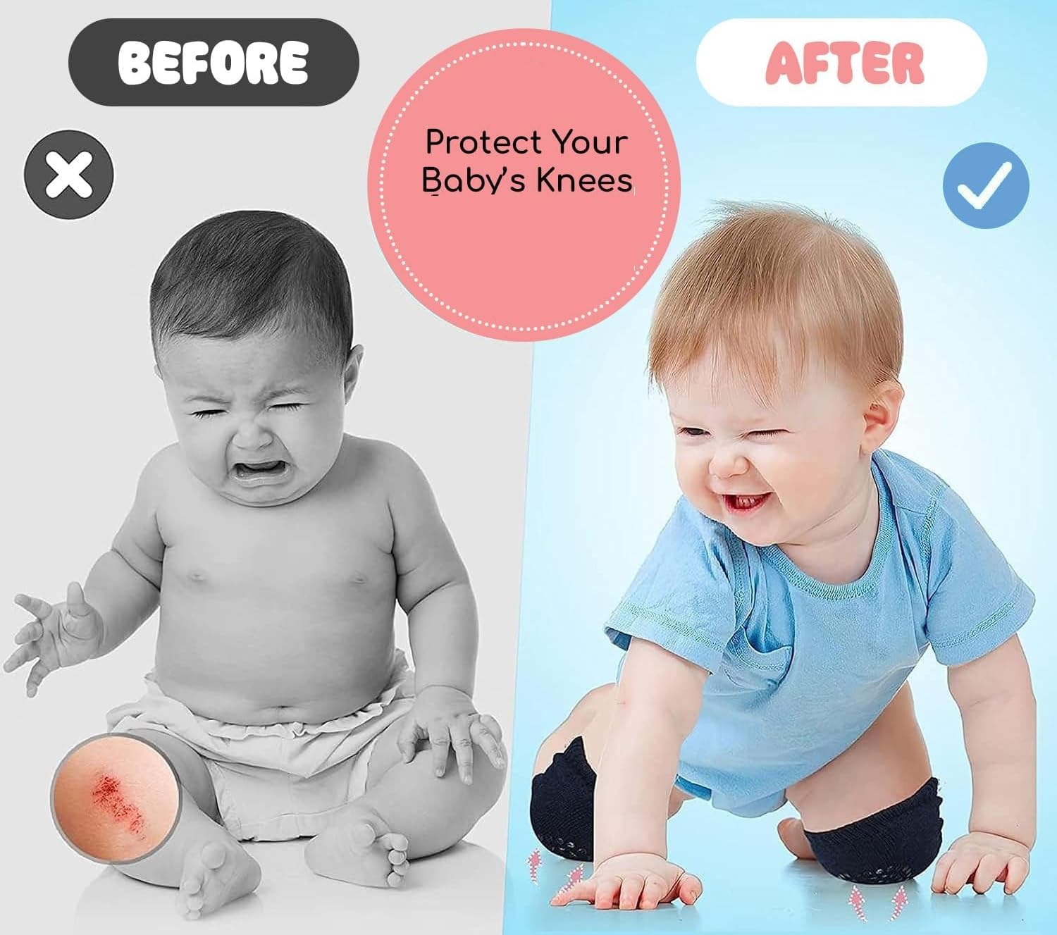 2 Pair Baby Knee & Elbow Pad Cushion, Infant Toddler Crawling Knee & Elbow Pads, Baby Leg Warmer Kneecap Protector for Kids, Multi-Color Safety Pads for Baby & Kids 2
