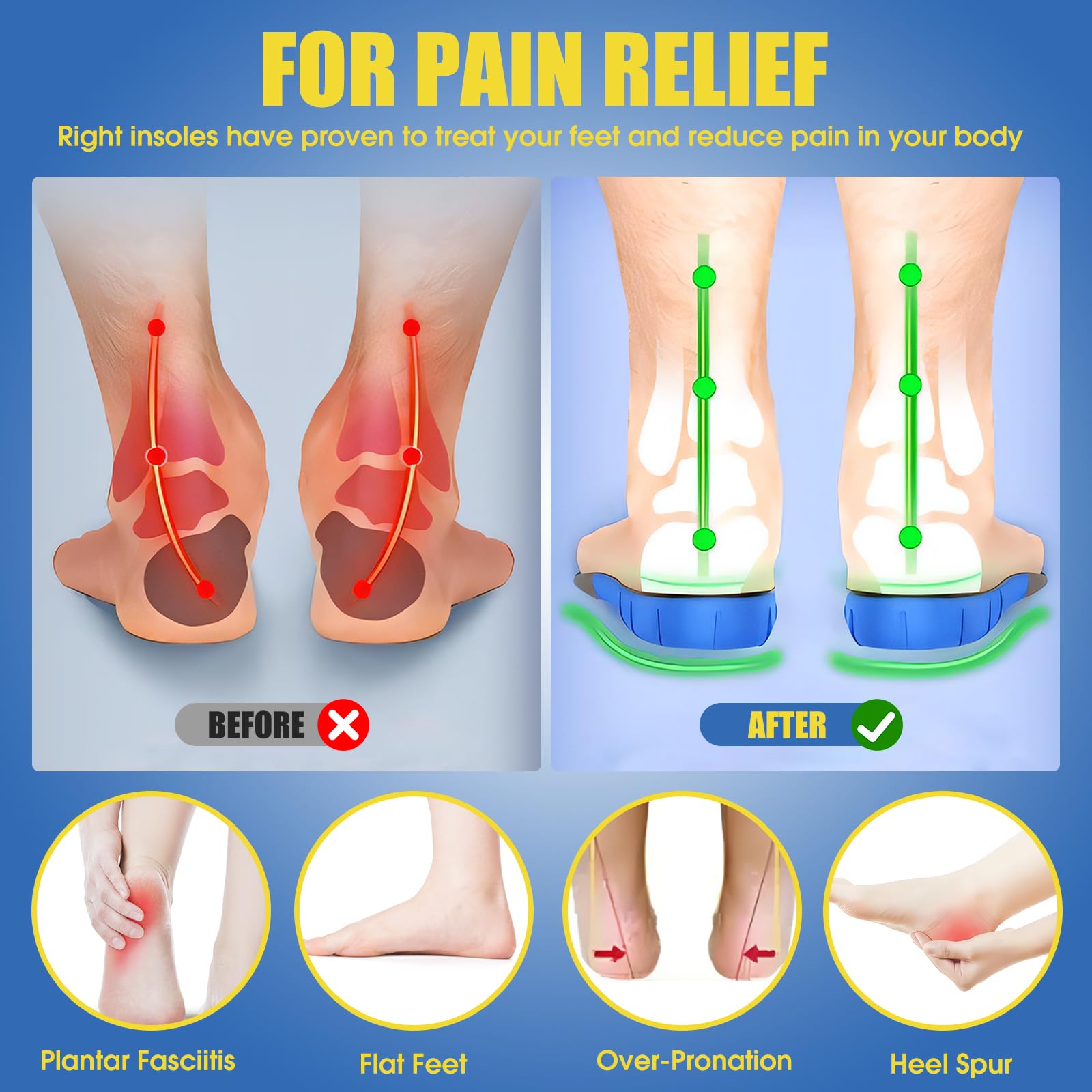 Plantillas Ortopédicas Gel para Fascitis Plantar, Hombre y Mujer, Pies Planos