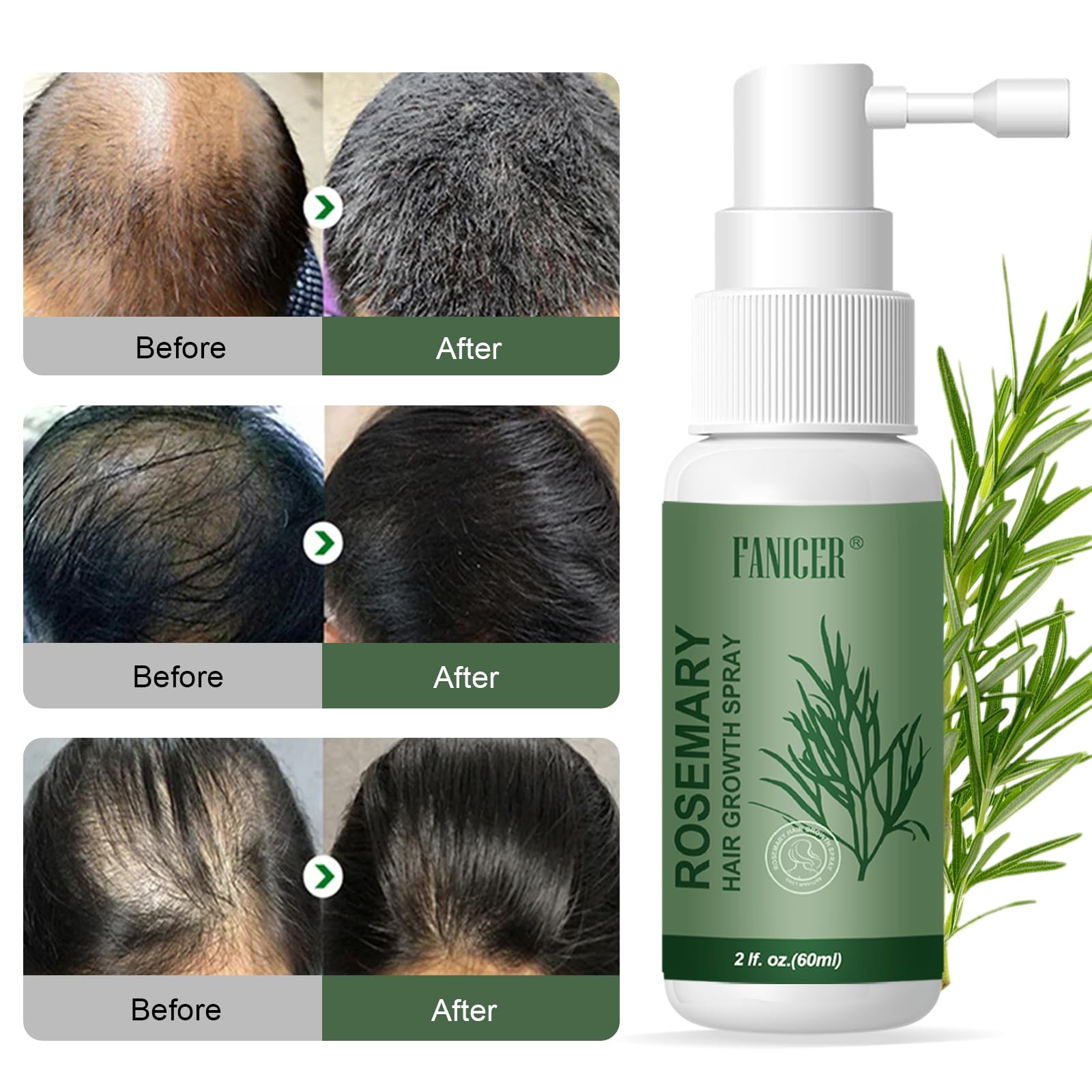 Serum Pousse Cheveux,Spray à Huile Essentielle De Romarin Pour La Croissance Des Cheveux,Growth Hair Oil,Huile de Pousse Cheveux Très Rapide,pour les Femmes et les Hommes (60ml)