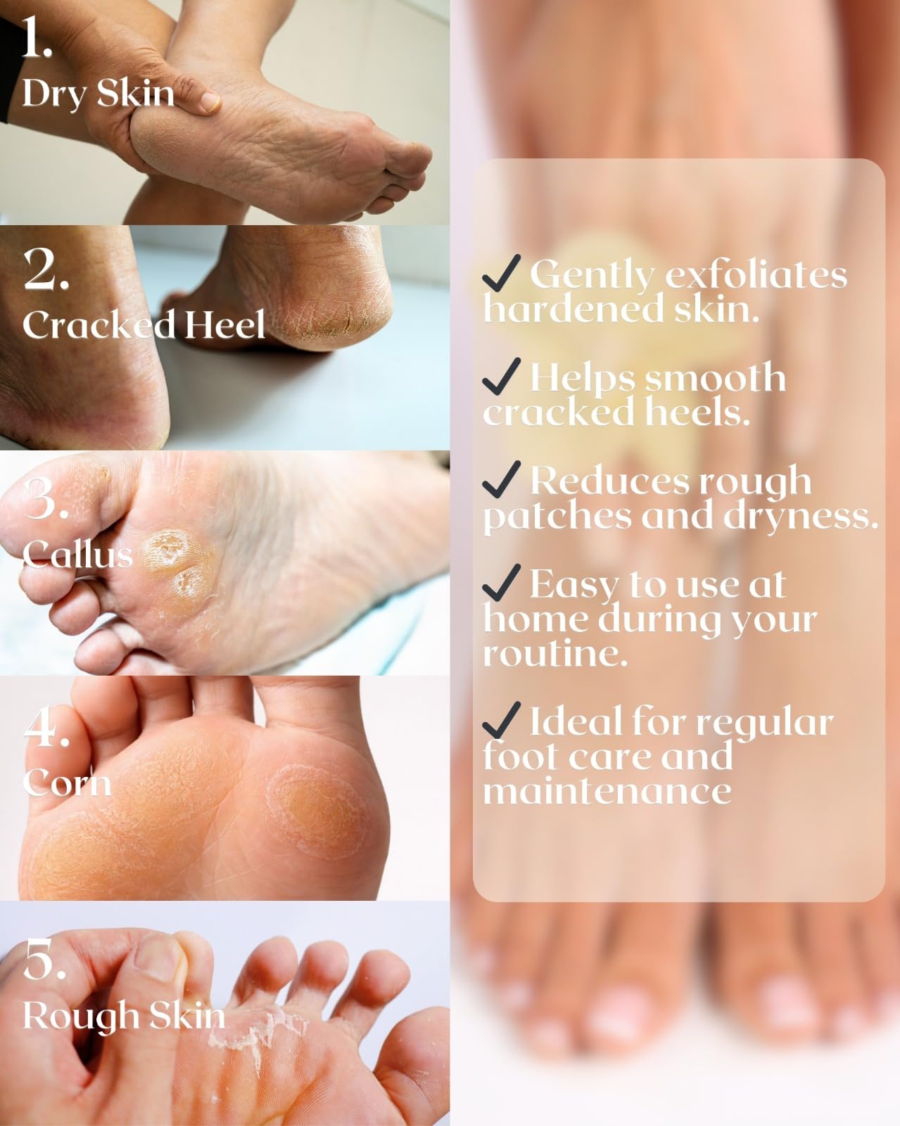 2 pietre pomice naturali, strumenti per pedicure e rimozione calli della pelle dura per piedi e mani, esfoliazione della lima per piedi per rimuovere la pelle morta e calli, 2 pezzi