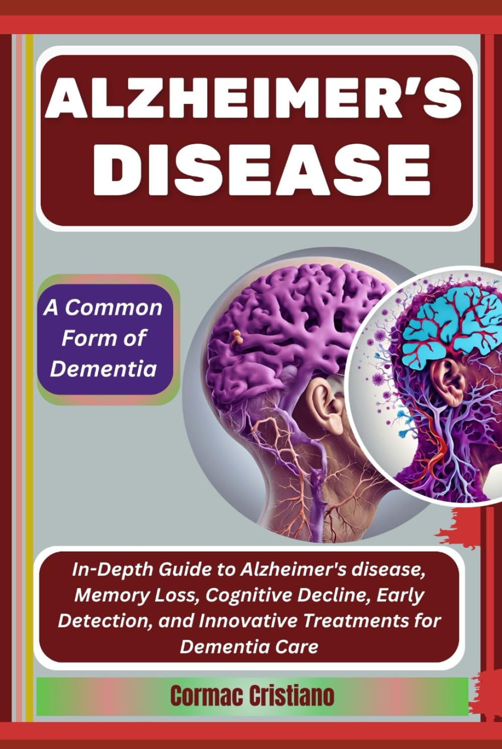 ALZHEIMER'S DISEASE: A Common Form of Dementia: In-Depth Guide to Alzheimer's disease, Memory Loss, Cognitive Decline, Early Detection, and Innovative Treatments for Dementia Care