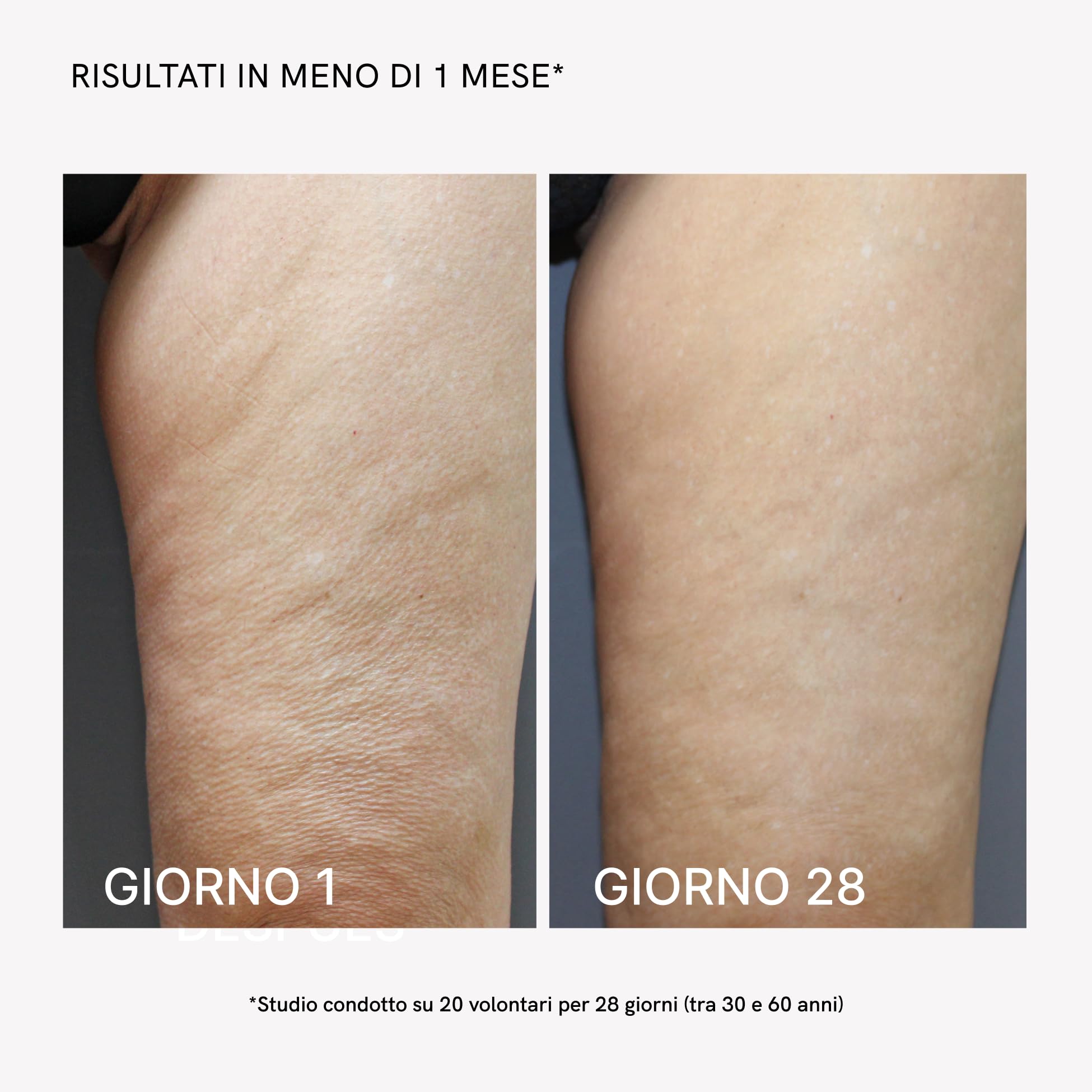 MASDERM Crema Conduttiva Tecar - 1 L per Radiofrequenza e Ultrasuoni Diatermia, Cavitazione con Equiseto Fucus Centella Asiatica, Effetto Rassodante e Idratante Uso Professionale