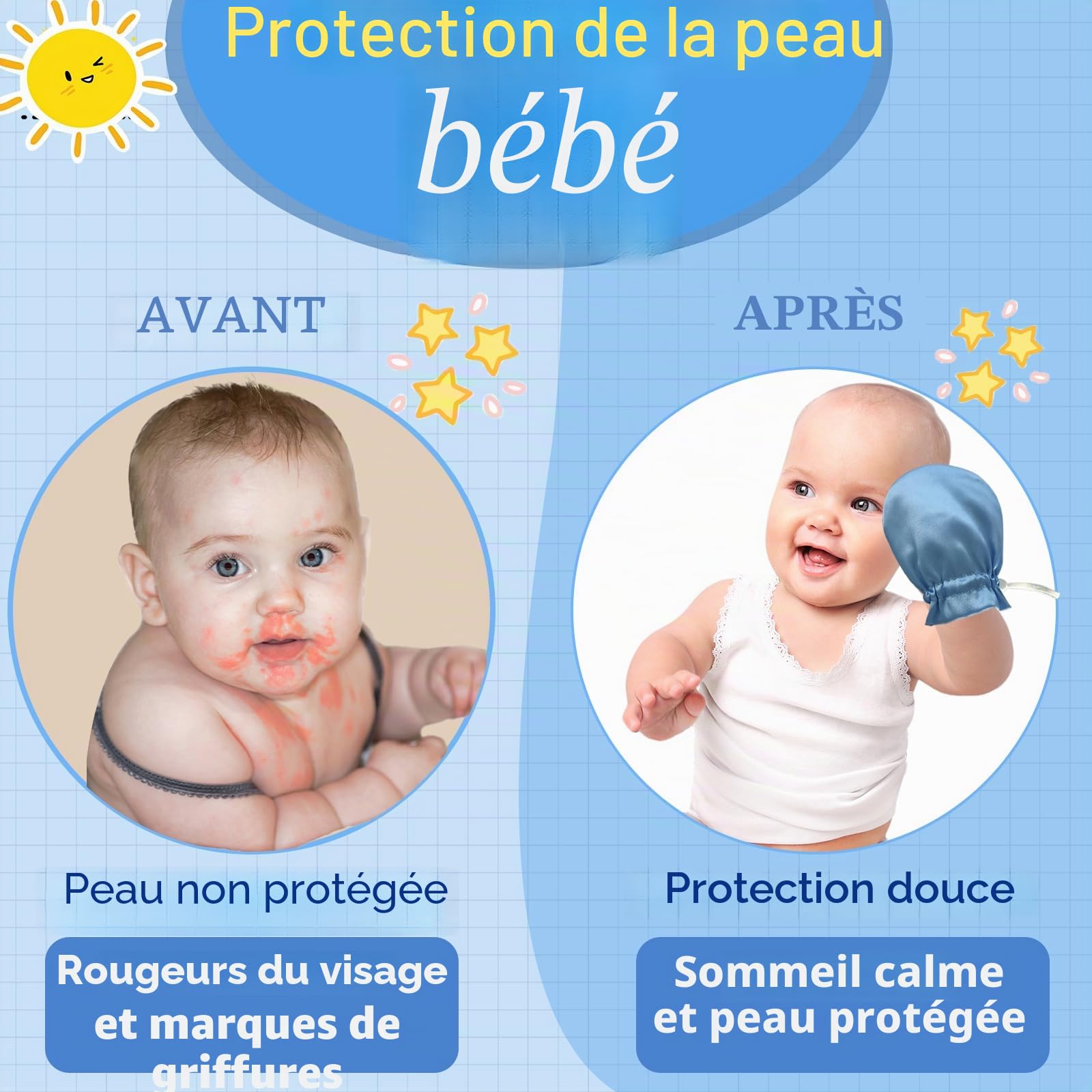 1 paire de gants anti-eczéma en satin pour bébés et enfants, gants anti-eczéma, anti-rayures, gants réglables pour soulager l'eczéma