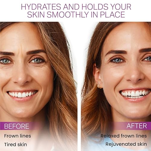 Miniatura 4 de Elevens - Parches antiarrugas para líneas fruncidas, parches antiarrugas no invasivos, cuidado de la piel antienvejecimiento, 30 parches, uso de 30