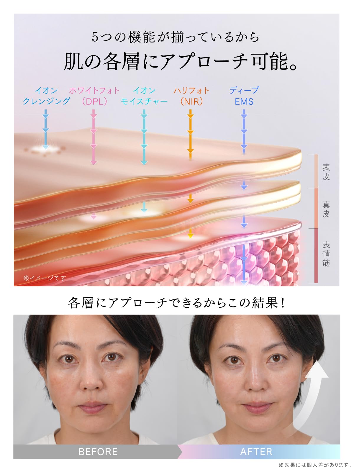 Amazon.co.jp: MYTREX マイトレックス 美顔器 MiRAY ONE EMS フォト