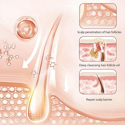 Miniatura 7 de Barra de champú para oscurecer y acondicionador de agua de arroz, barra de jabón para el crecimiento del cabello con agua de arroz para adelgazar el