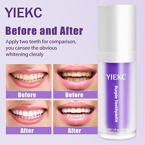 Miniatura 2 de Purple Toothpaste for Teeth Whitening,Recipe Upgrade,v34 Colour Corrector, Tooth Stain Removal, Teeth Whitening Booster, Colour Correcting,